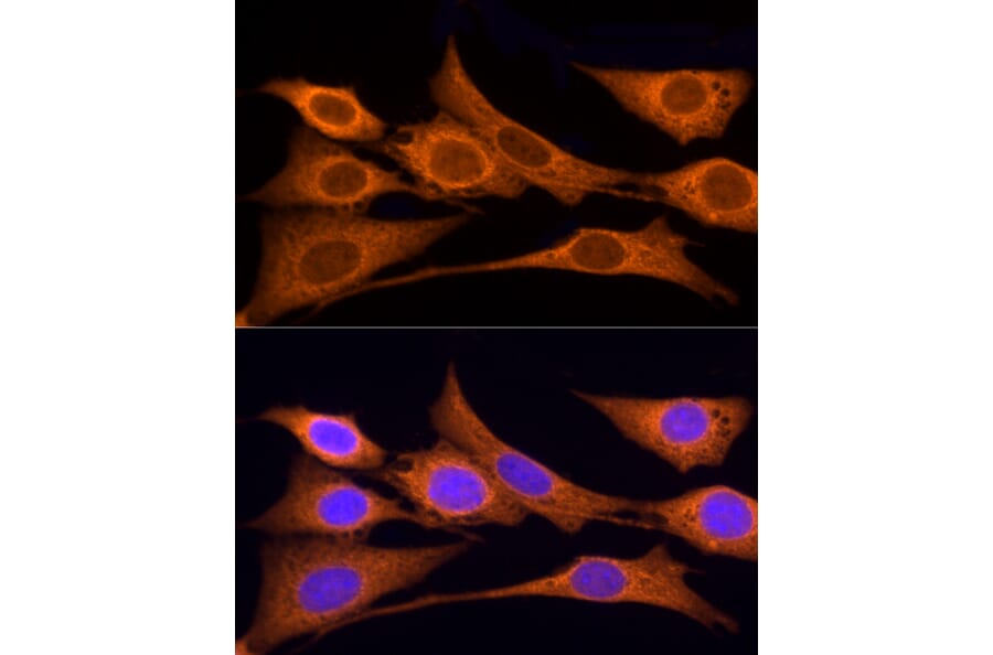 Immunofluorescence - Anti-Iduronate 2 sulfatase/SIDS Antibody (A13705) - Antibodies.com