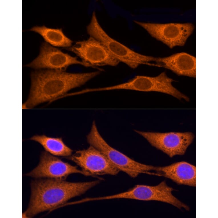 Immunofluorescence - Anti-Iduronate 2 sulfatase/SIDS Antibody (A13705) - Antibodies.com