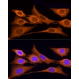 Immunofluorescence - Anti-Iduronate 2 sulfatase/SIDS Antibody (A13705) - Antibodies.com