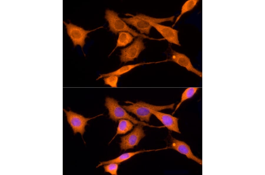 Immunofluorescence - Anti-Iduronate 2 sulfatase/SIDS Antibody (A13705) - Antibodies.com