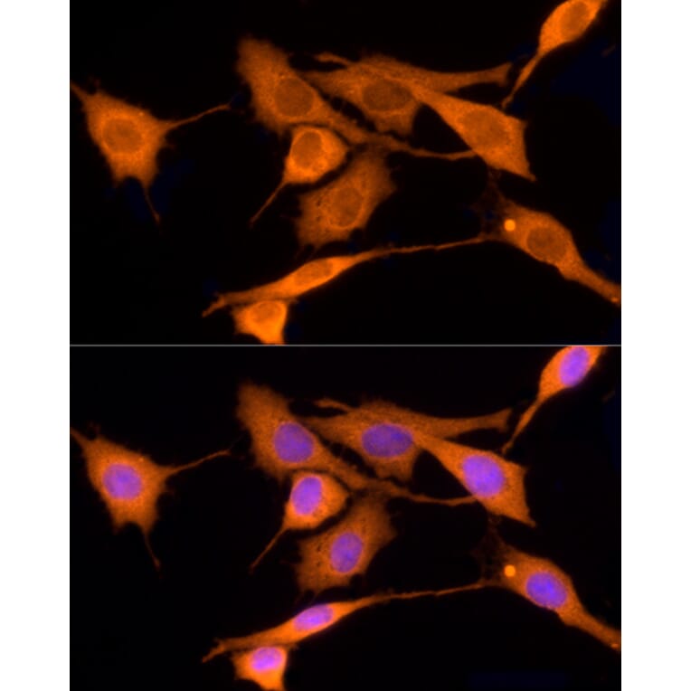 Immunofluorescence - Anti-Iduronate 2 sulfatase/SIDS Antibody (A13705) - Antibodies.com
