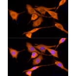 Immunofluorescence - Anti-Iduronate 2 sulfatase/SIDS Antibody (A13705) - Antibodies.com