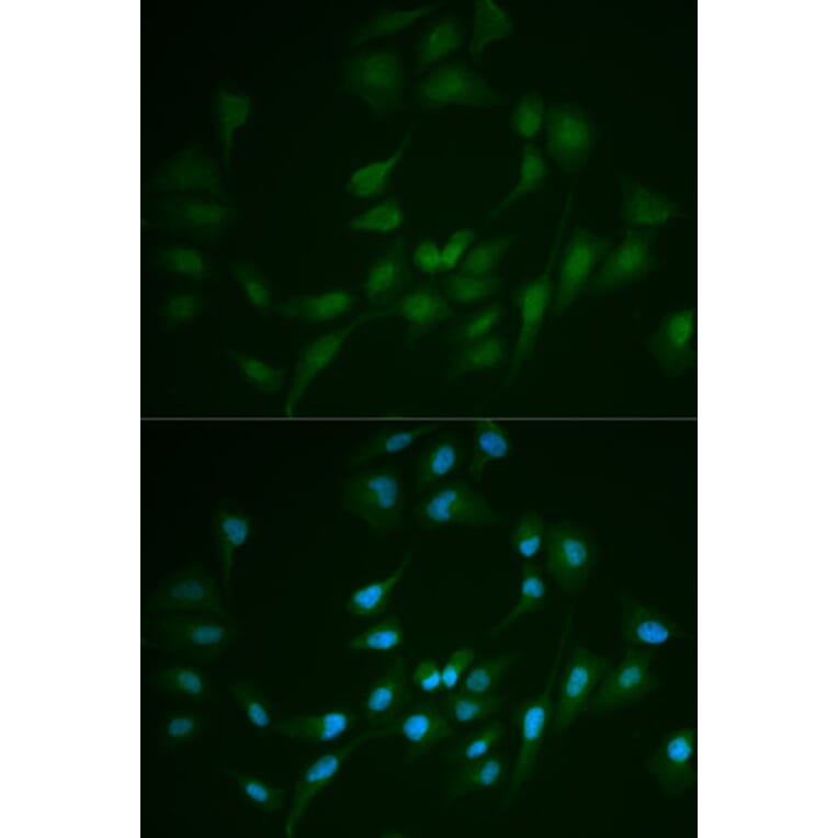 Immunofluorescence - Anti-LIG1 Antibody (A13706) - Antibodies.com