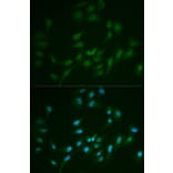Immunofluorescence - Anti-LIG1 Antibody (A13706) - Antibodies.com