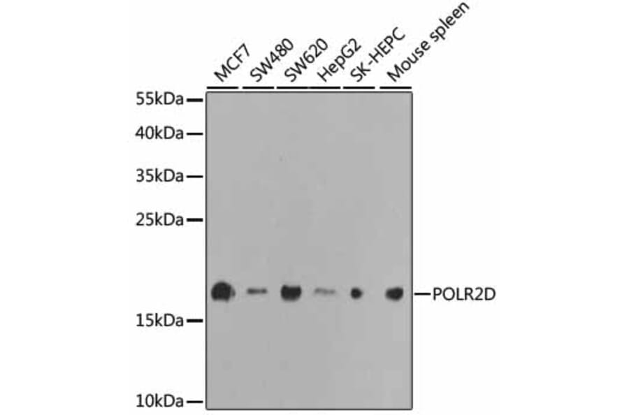 Western Blot - Anti-RNA polymerase II RPB4 Antibody (A13707) - Antibodies.com