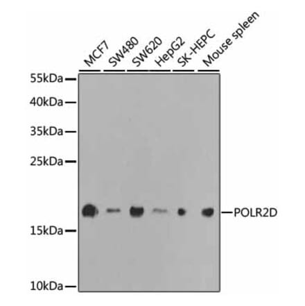 Western Blot - Anti-RNA polymerase II RPB4 Antibody (A13707) - Antibodies.com