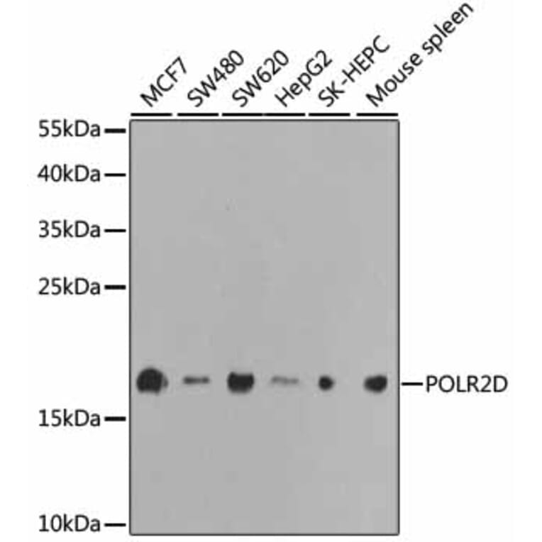 Western Blot - Anti-RNA polymerase II RPB4 Antibody (A13707) - Antibodies.com