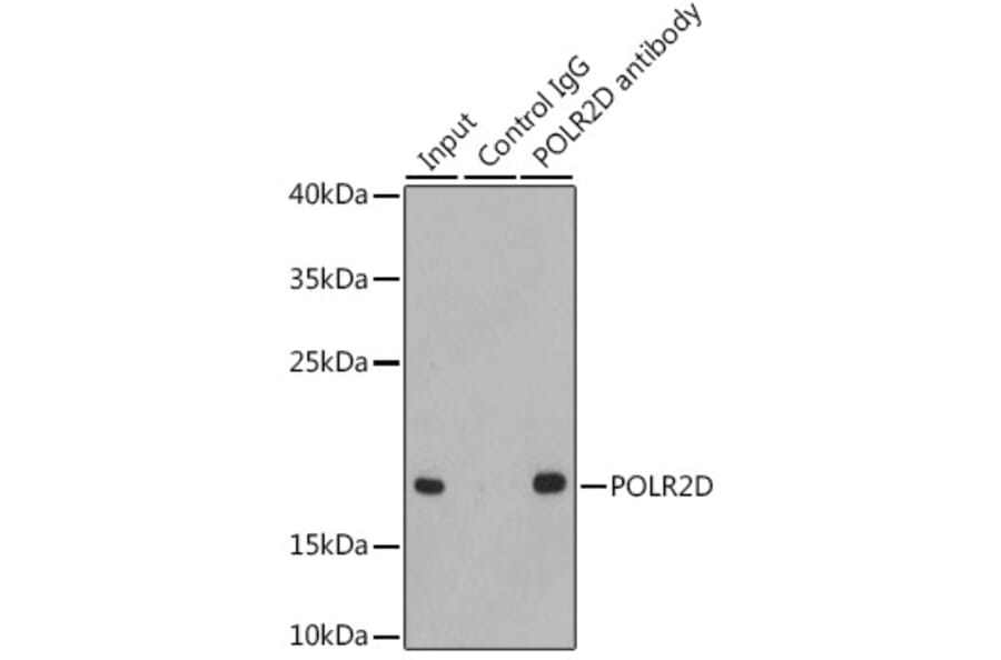 Western Blot - Anti-RNA polymerase II RPB4 Antibody (A13707) - Antibodies.com