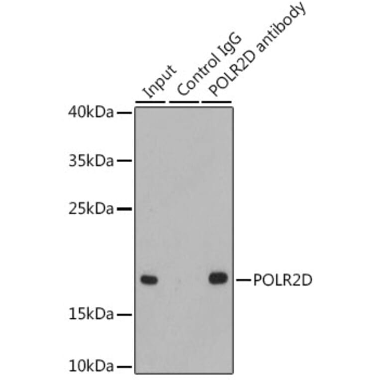 Western Blot - Anti-RNA polymerase II RPB4 Antibody (A13707) - Antibodies.com