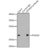 Western Blot - Anti-RNA polymerase II RPB4 Antibody (A13707) - Antibodies.com