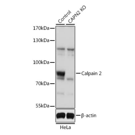 Western Blot - Anti-Calpain 2 Antibody (A13708) - Antibodies.com