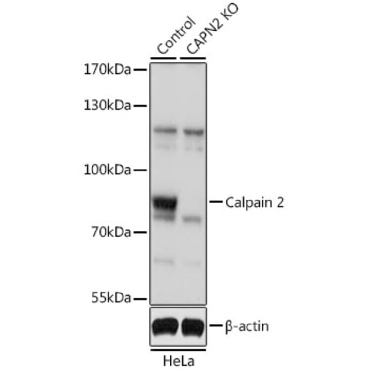 Western Blot - Anti-Calpain 2 Antibody (A13708) - Antibodies.com
