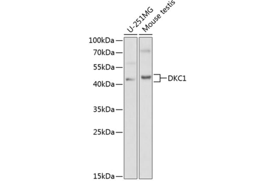Western Blot - Anti-DKC1/Dyskerin Antibody (A13709) - Antibodies.com