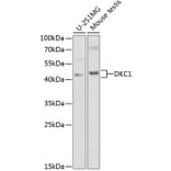 Western Blot - Anti-DKC1/Dyskerin Antibody (A13709) - Antibodies.com