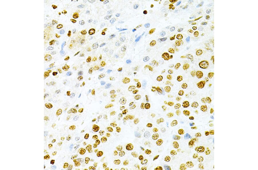 Immunohistochemistry - Anti-DKC1/Dyskerin Antibody (A13709) - Antibodies.com