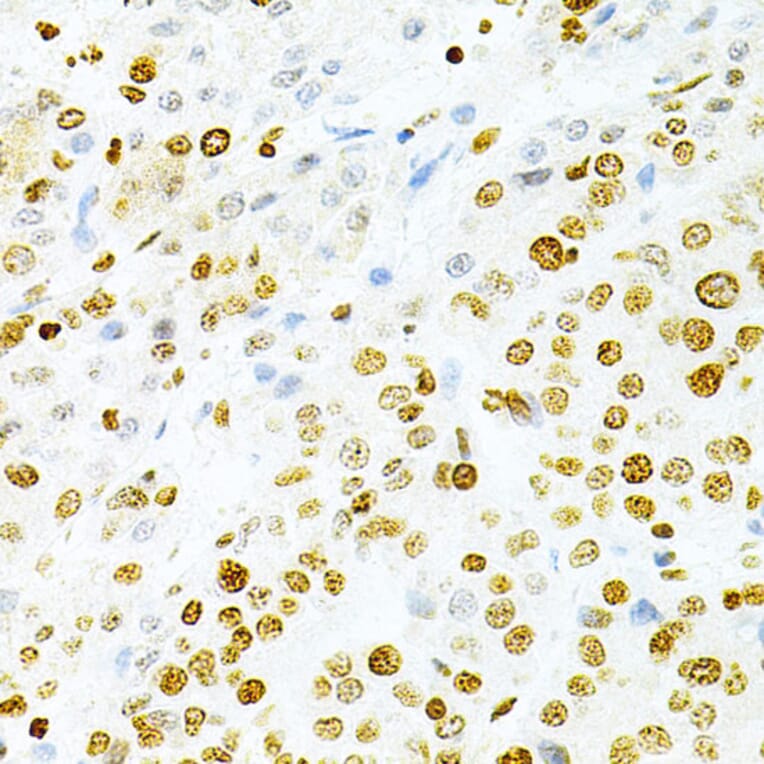 Immunohistochemistry - Anti-DKC1/Dyskerin Antibody (A13709) - Antibodies.com