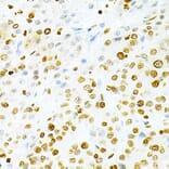 Immunohistochemistry - Anti-DKC1/Dyskerin Antibody (A13709) - Antibodies.com