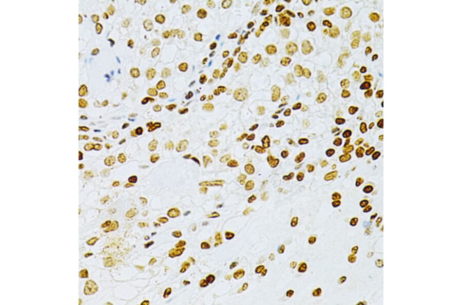 Immunohistochemistry - Anti-DKC1/Dyskerin Antibody (A13709) - Antibodies.com
