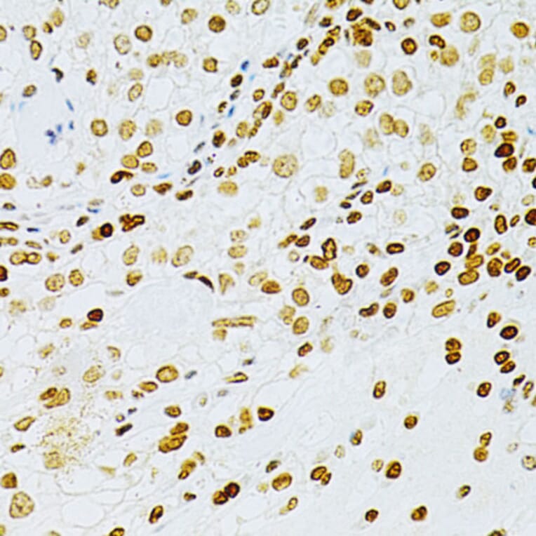 Immunohistochemistry - Anti-DKC1/Dyskerin Antibody (A13709) - Antibodies.com