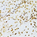 Immunohistochemistry - Anti-DKC1/Dyskerin Antibody (A13709) - Antibodies.com
