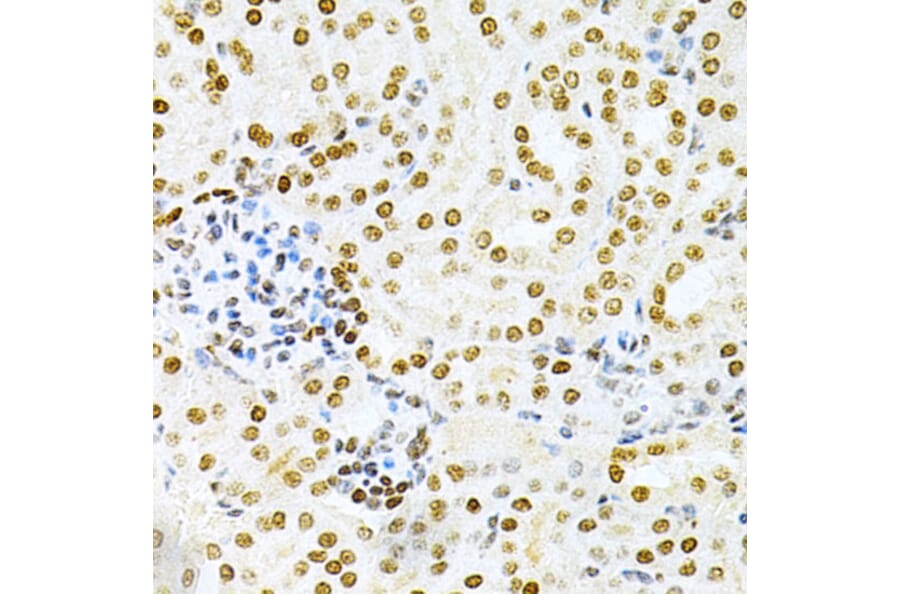 Immunohistochemistry - Anti-DKC1/Dyskerin Antibody (A13709) - Antibodies.com
