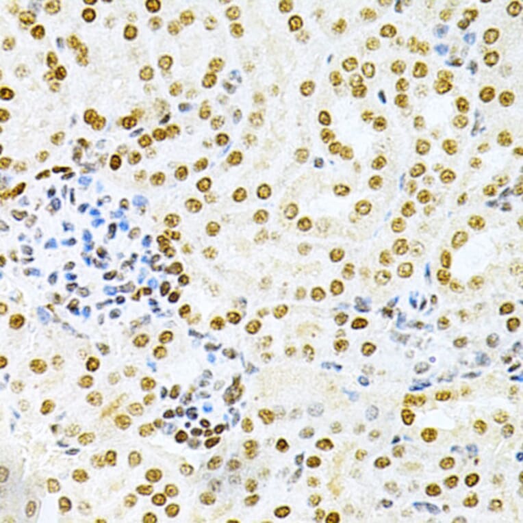 Immunohistochemistry - Anti-DKC1/Dyskerin Antibody (A13709) - Antibodies.com