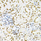 Immunohistochemistry - Anti-DKC1/Dyskerin Antibody (A13709) - Antibodies.com