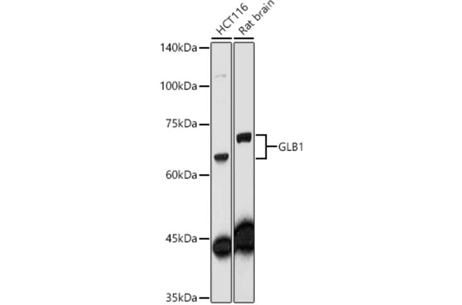 Western Blot - Anti-GLB1/Beta-galactosidase Antibody (A13710) - Antibodies.com