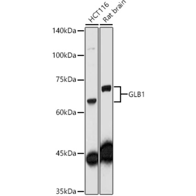 Western Blot - Anti-GLB1/Beta-galactosidase Antibody (A13710) - Antibodies.com
