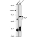 Western Blot - Anti-GLB1/Beta-galactosidase Antibody (A13710) - Antibodies.com