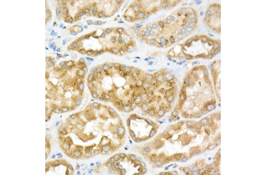Immunohistochemistry - Anti-GLB1/Beta-galactosidase Antibody (A13710) - Antibodies.com