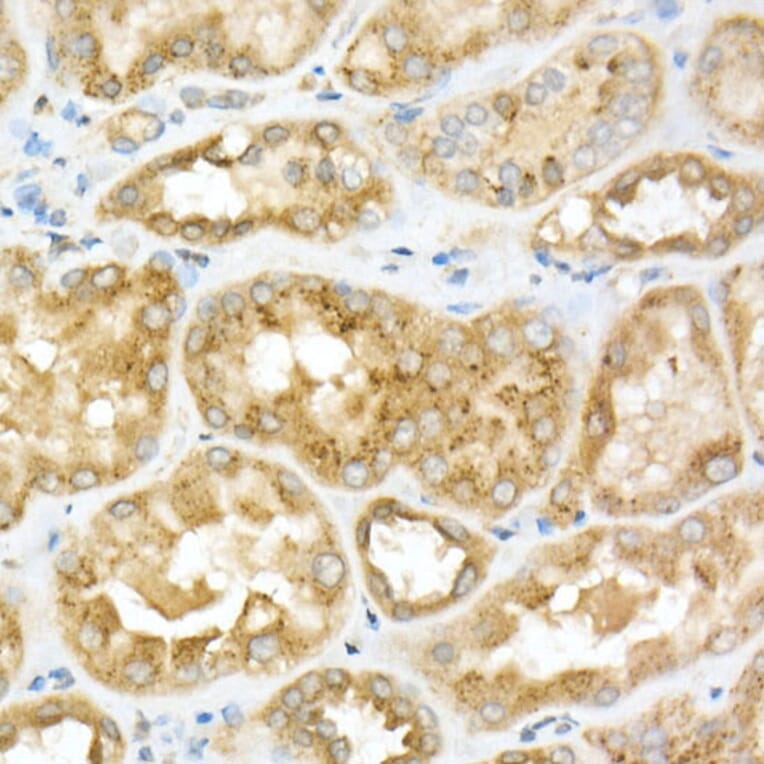 Immunohistochemistry - Anti-GLB1/Beta-galactosidase Antibody (A13710) - Antibodies.com