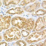 Immunohistochemistry - Anti-GLB1/Beta-galactosidase Antibody (A13710) - Antibodies.com