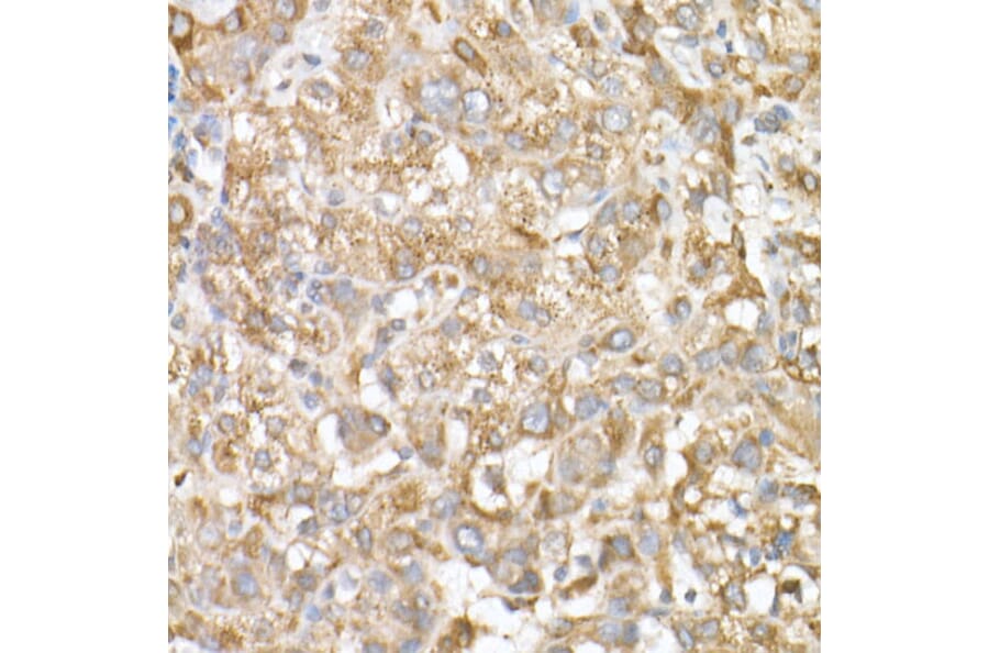 Immunohistochemistry - Anti-GLB1/Beta-galactosidase Antibody (A13710) - Antibodies.com
