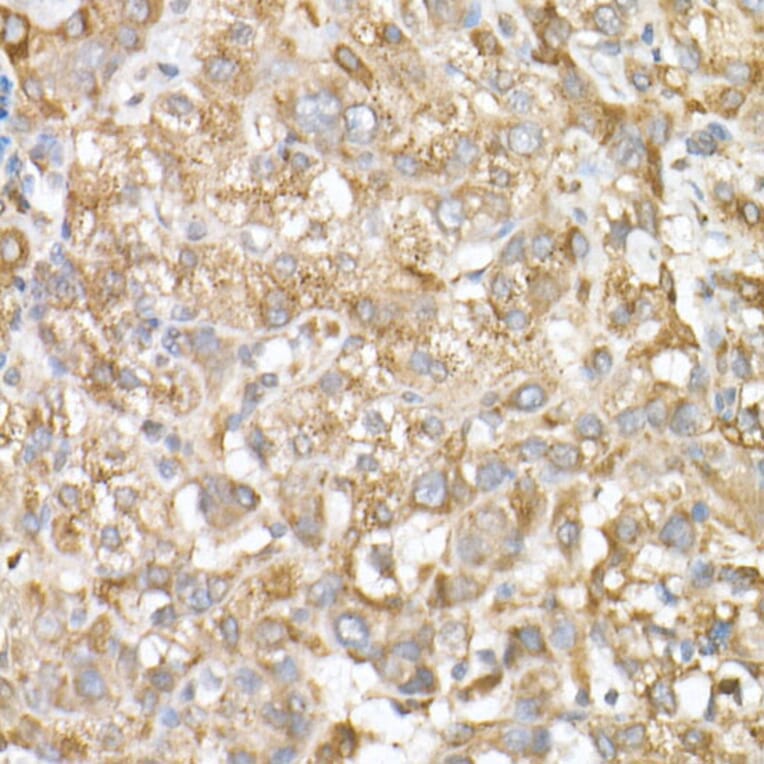 Immunohistochemistry - Anti-GLB1/Beta-galactosidase Antibody (A13710) - Antibodies.com