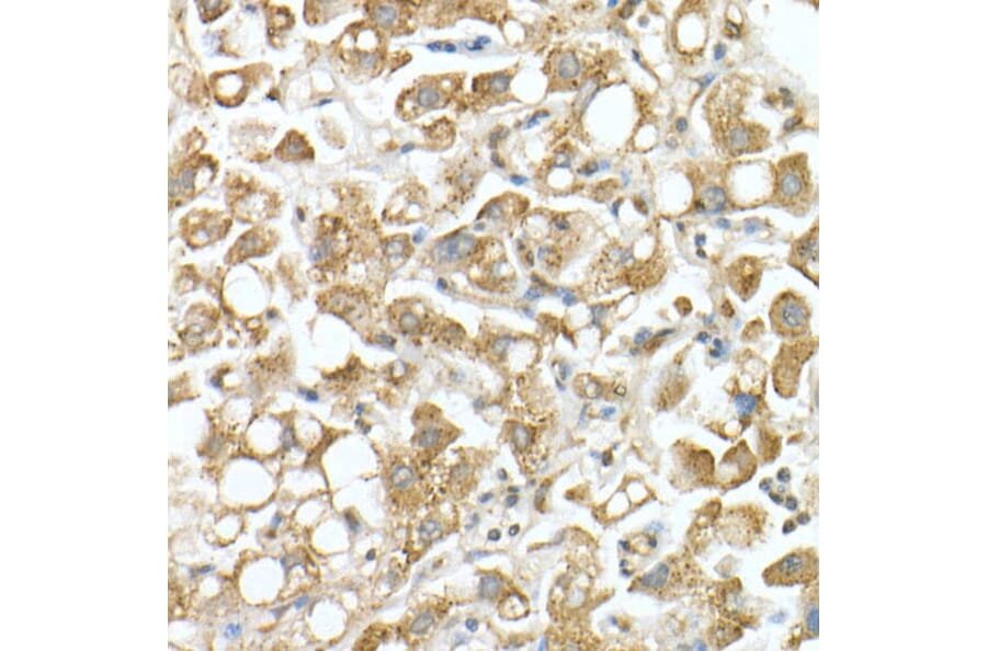 Immunohistochemistry - Anti-GLB1/Beta-galactosidase Antibody (A13710) - Antibodies.com