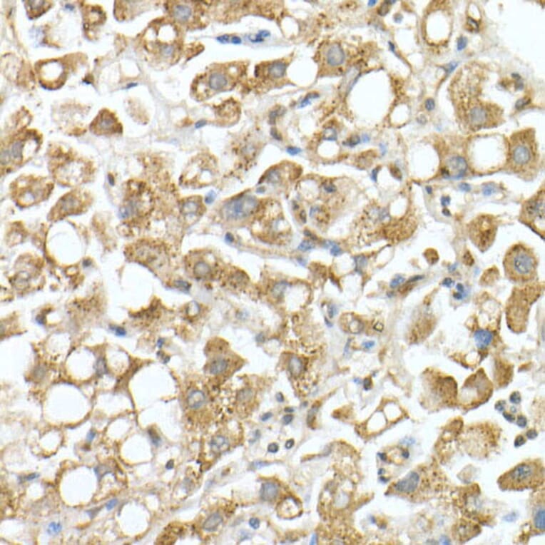 Immunohistochemistry - Anti-GLB1/Beta-galactosidase Antibody (A13710) - Antibodies.com