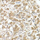 Immunohistochemistry - Anti-GLB1/Beta-galactosidase Antibody (A13710) - Antibodies.com