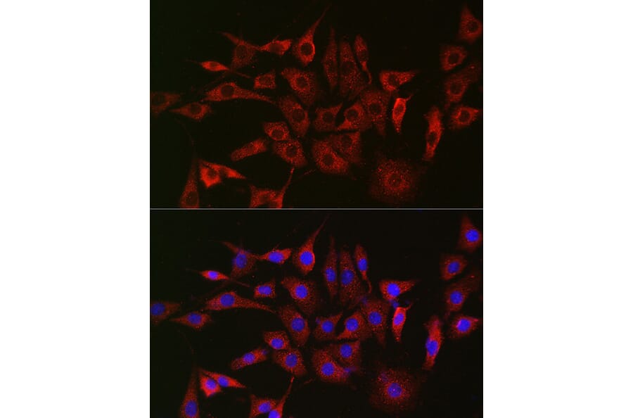 Immunofluorescence - Anti-GLB1/Beta-galactosidase Antibody (A13710) - Antibodies.com