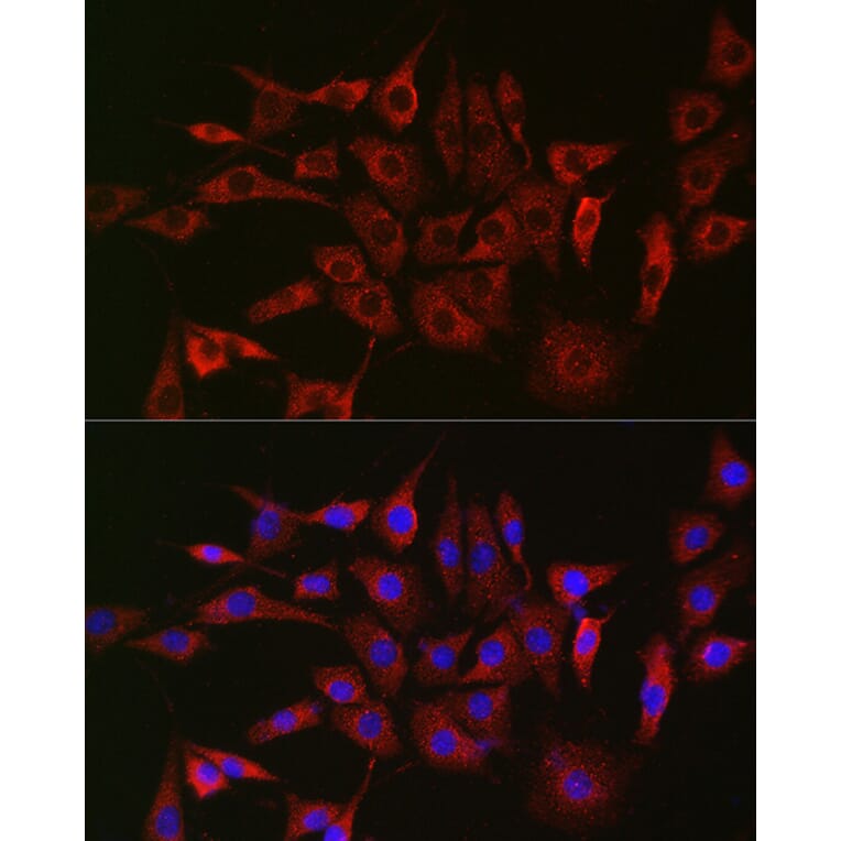 Immunofluorescence - Anti-GLB1/Beta-galactosidase Antibody (A13710) - Antibodies.com