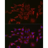 Immunofluorescence - Anti-GLB1/Beta-galactosidase Antibody (A13710) - Antibodies.com