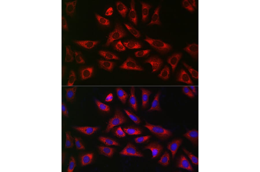 Immunofluorescence - Anti-GLB1/Beta-galactosidase Antibody (A13710) - Antibodies.com