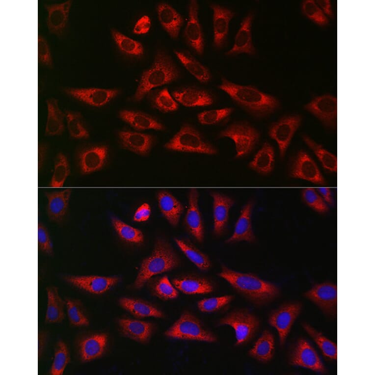 Immunofluorescence - Anti-GLB1/Beta-galactosidase Antibody (A13710) - Antibodies.com