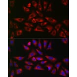 Immunofluorescence - Anti-GLB1/Beta-galactosidase Antibody (A13710) - Antibodies.com