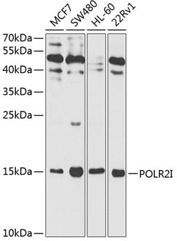 Western blot analysis of extracts of various cell lines, using Anti-POLR2I Antibody (A1865) at 1:1,000 dilution.
Secondary antibody: Goat Anti-Rabbit IgG (H+L) (HRP) (AS014) at 1:10,000 dilution.
Lysates / proteins: 25µg per lane.
Blocking buffer: 3% non-fat dry milk in TBST.