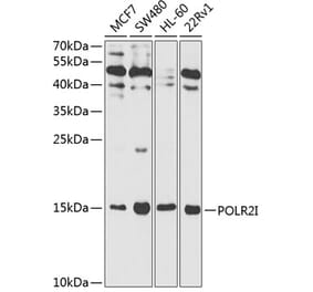 Western Blot - Anti-POLR2I Antibody (A13711) - Antibodies.com