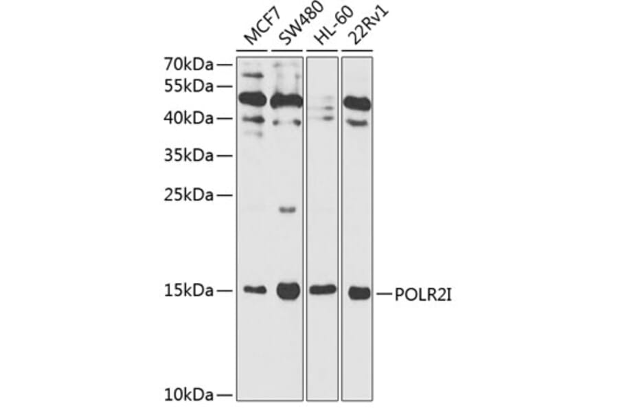 Western Blot - Anti-POLR2I Antibody (A13711) - Antibodies.com