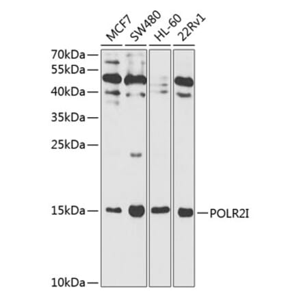 Western Blot - Anti-POLR2I Antibody (A13711) - Antibodies.com