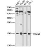 Western Blot - Anti-POLR2I Antibody (A13711) - Antibodies.com