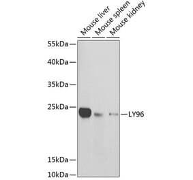Western Blot - Anti-MD2 Antibody (A13712) - Antibodies.com